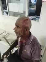 शाजापुर: खेत की मेढ़ से ट्रैक्टर निकालने को लेकर खूनी संघर्ष, पड़ोसी ने लाठी से हमला कर बुजुर्ग का सिर फोड़ा