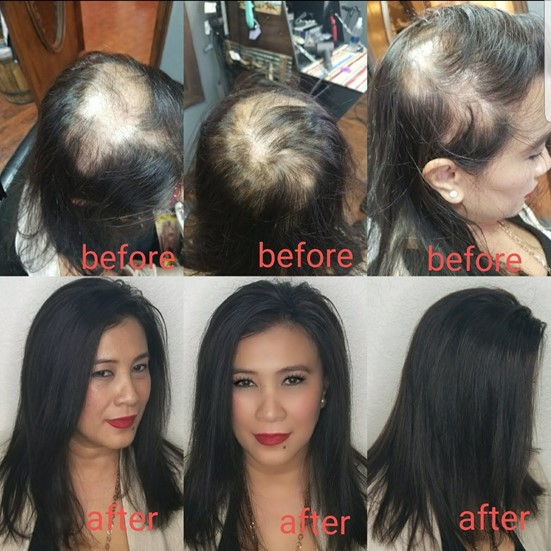 Some Basics On Naturally Regrowing Your Hair – Hair Beauty And Styling Company Salon