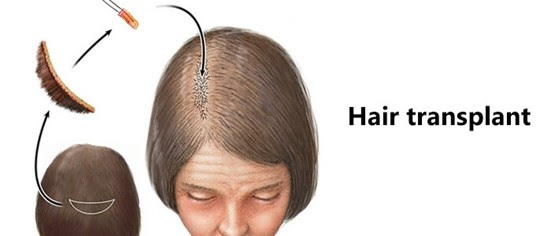 Understanding Hair Loss And Hair Fall