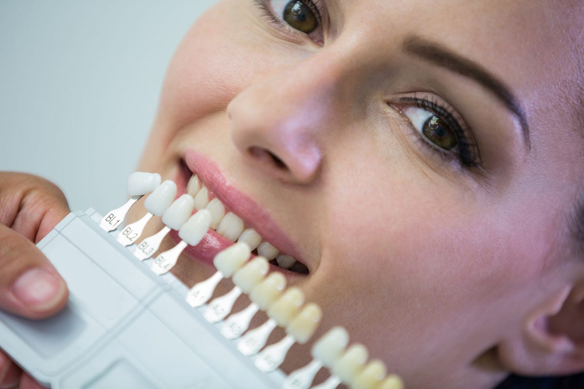 How Metal Free Ceramic Crowns in Goa Are Revolutionising Dental Care? | by Dr. Dmellos Smile Dental Clinic | May, 2025 | Medium