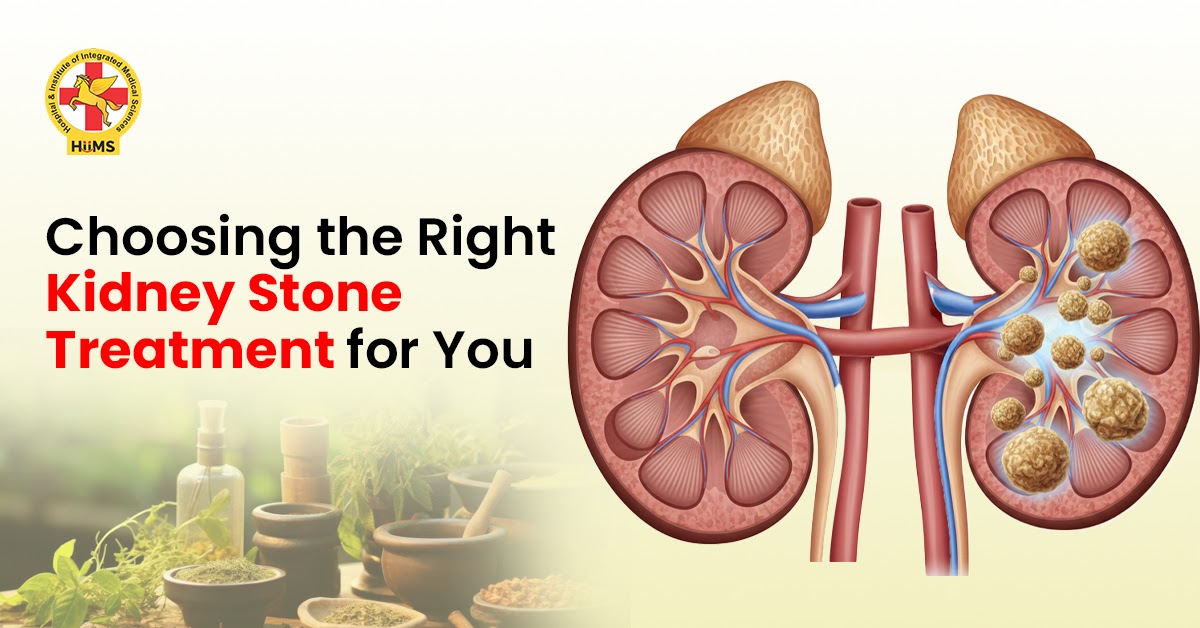 Kidney Stone Treatment in Bangalore – Comprehensive Care at Jeena Sikho HiiMS Kidney Hospital