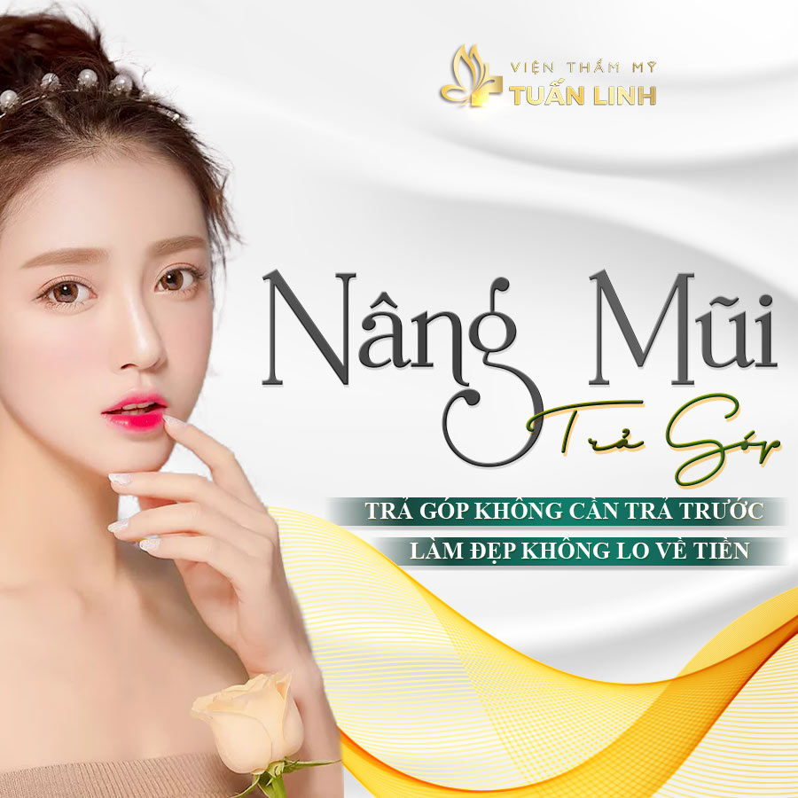 Nâng mũi trả góp - Trả góp không cần trả trước - Làm đẹp không lo về tiền