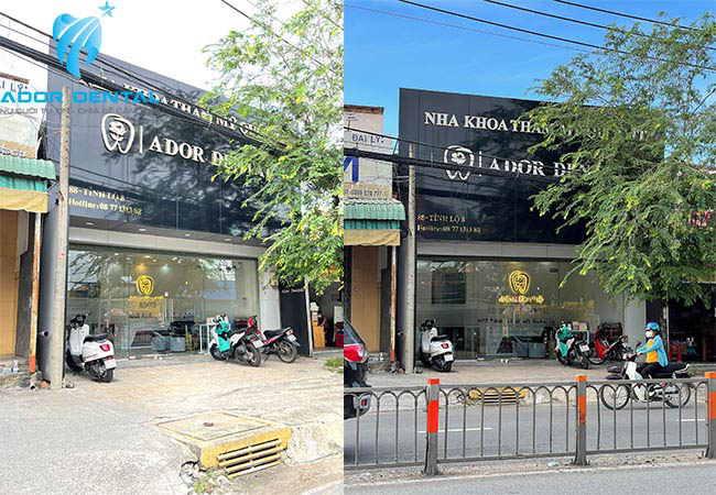 Phòng Khám Nha Khoa Uy Tín Huyện CỦ CHI ADOR Dental 2022