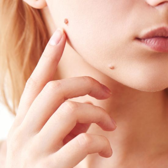 Best Skin Specialist in Ludhiana, Top Best Dermatologist Clinic in Ludhiana Punjab