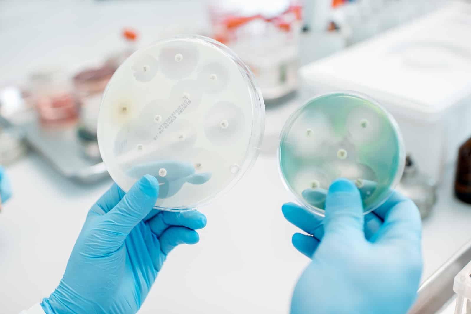 Bacteria Air Testing NYC | Air & Surface | Culture | PCR | Accurate Results