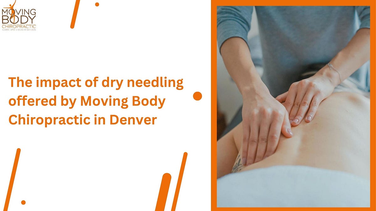 The impact of dry needling offered by Moving Body Chiropractic in Denver | by Movingbodychiropractic | Feb, 2024 | Medium