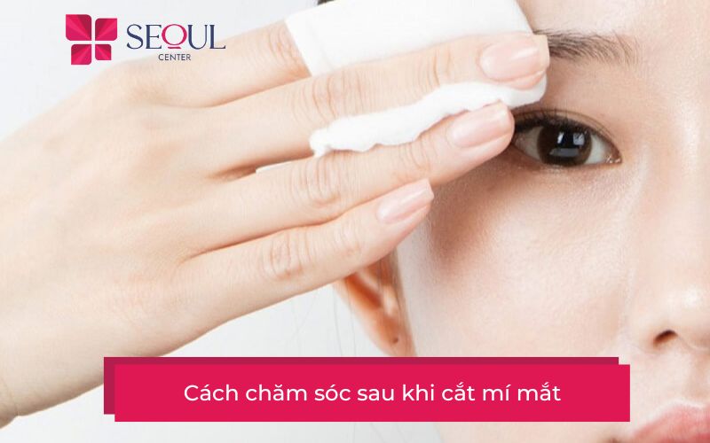 Hướng dẫn cách chăm sóc sau cắt mí giúp nhanh lành vết thương