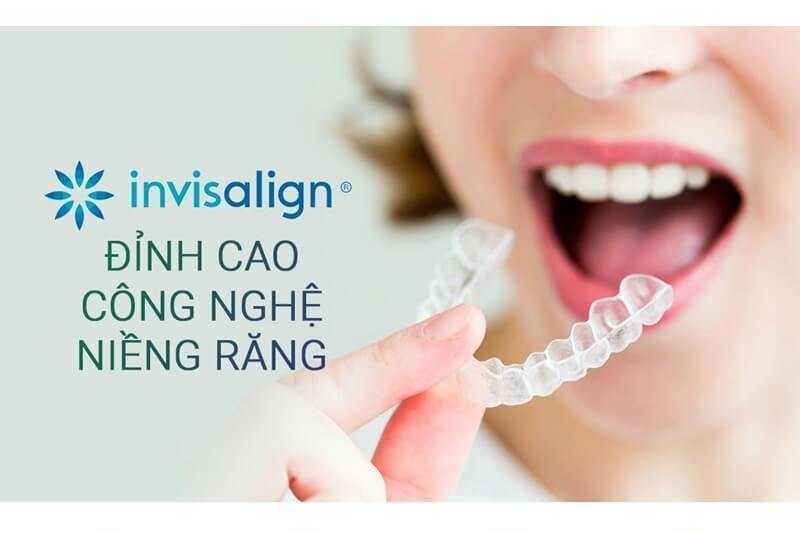 Niềng răng invisalign có hiệu quả không? Có nên niềng răng invisalign?