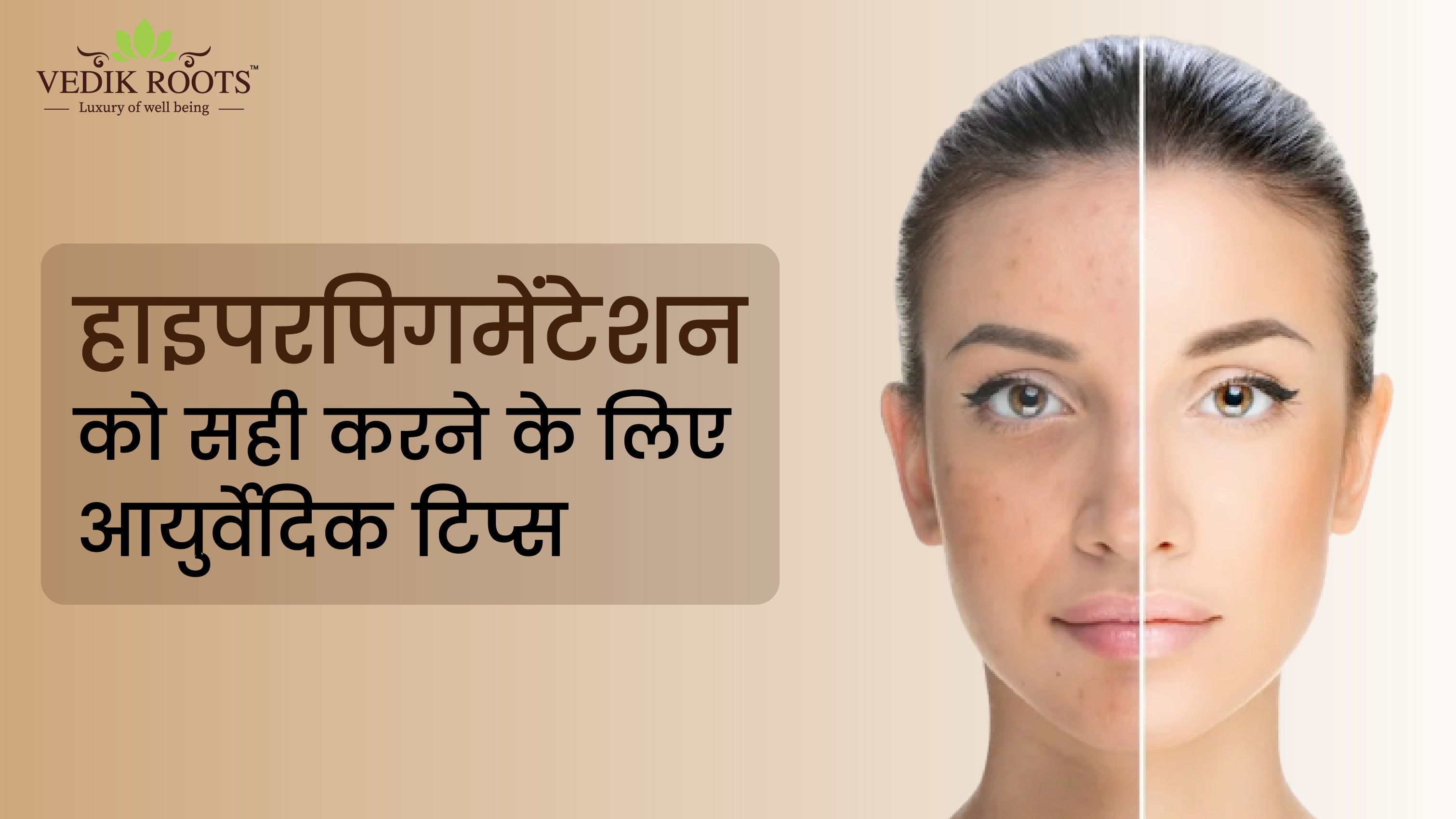 हाइपरपिगमेंटेशन को निपटाने के लिए आयुर्वेदिक टिप्स       – Vedikroots