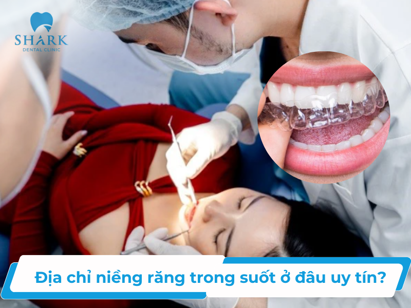 TOP 11 địa chỉ niềng răng trong suốt uy tín được yêu thích nhất