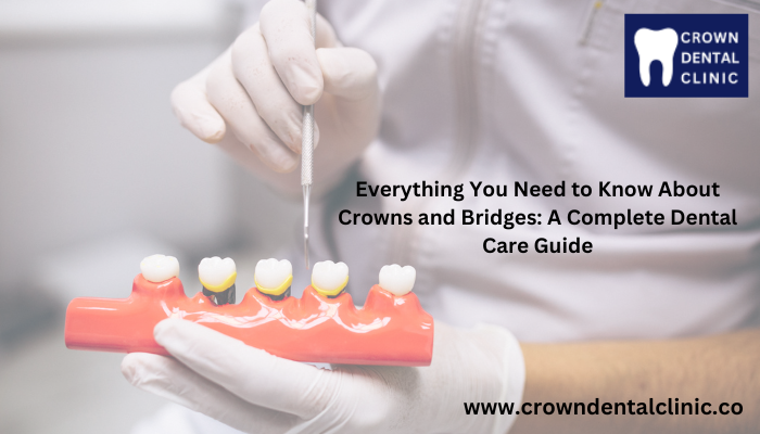 Everything You Need to Know About Crowns and Bridges: A Complete Dental Care Guide - Free Article Submission Sites List instant Approval - Post Your Article