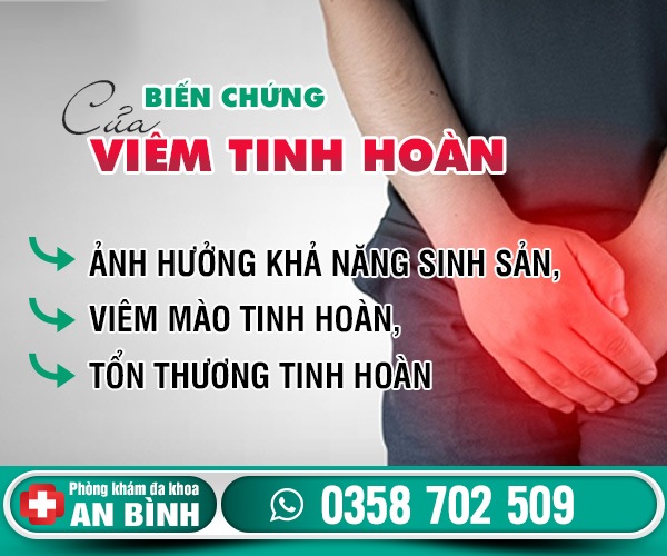 Địa chỉ chữa bệnh viêm tinh hoàn ở Hưng Yên