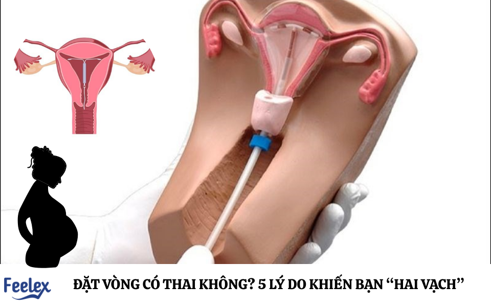 Đặt vòng có thai không? 5 lý do khiến bạn “hai vạch”