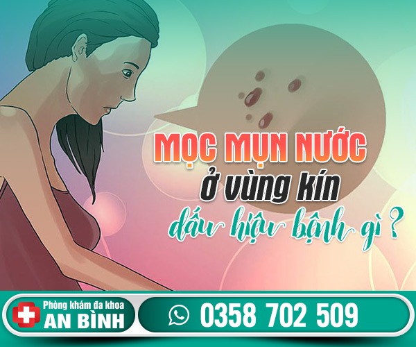 Mọc mụn nước ở vùng kín nữ có nguy hiểm không?