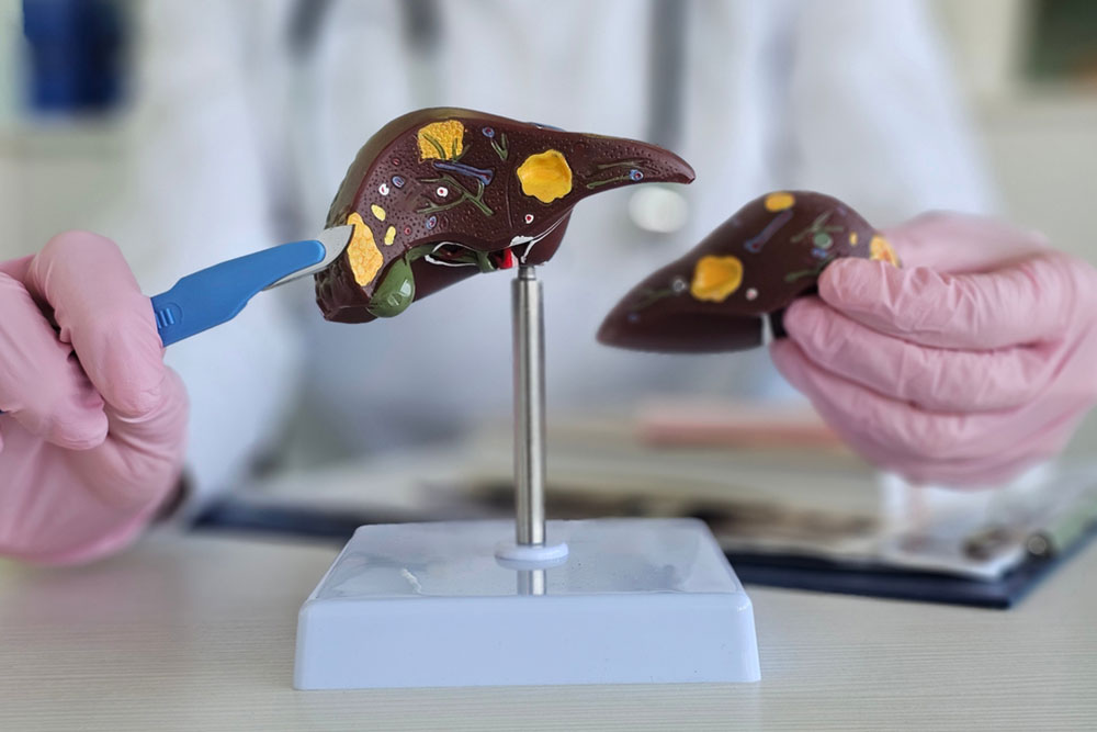 Liver & Pancreatic Cancer Surgery in Vijayawada | Dr. R J Dinesh Reddy