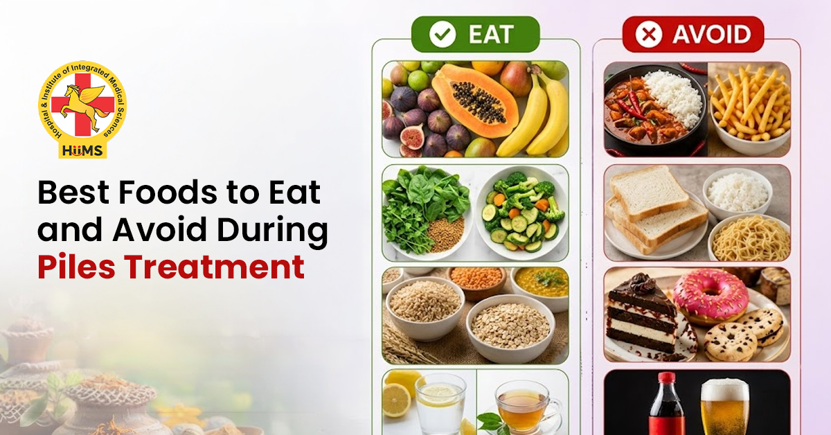 Piles Diet: What to Eat and Avoid During Piles Treatment