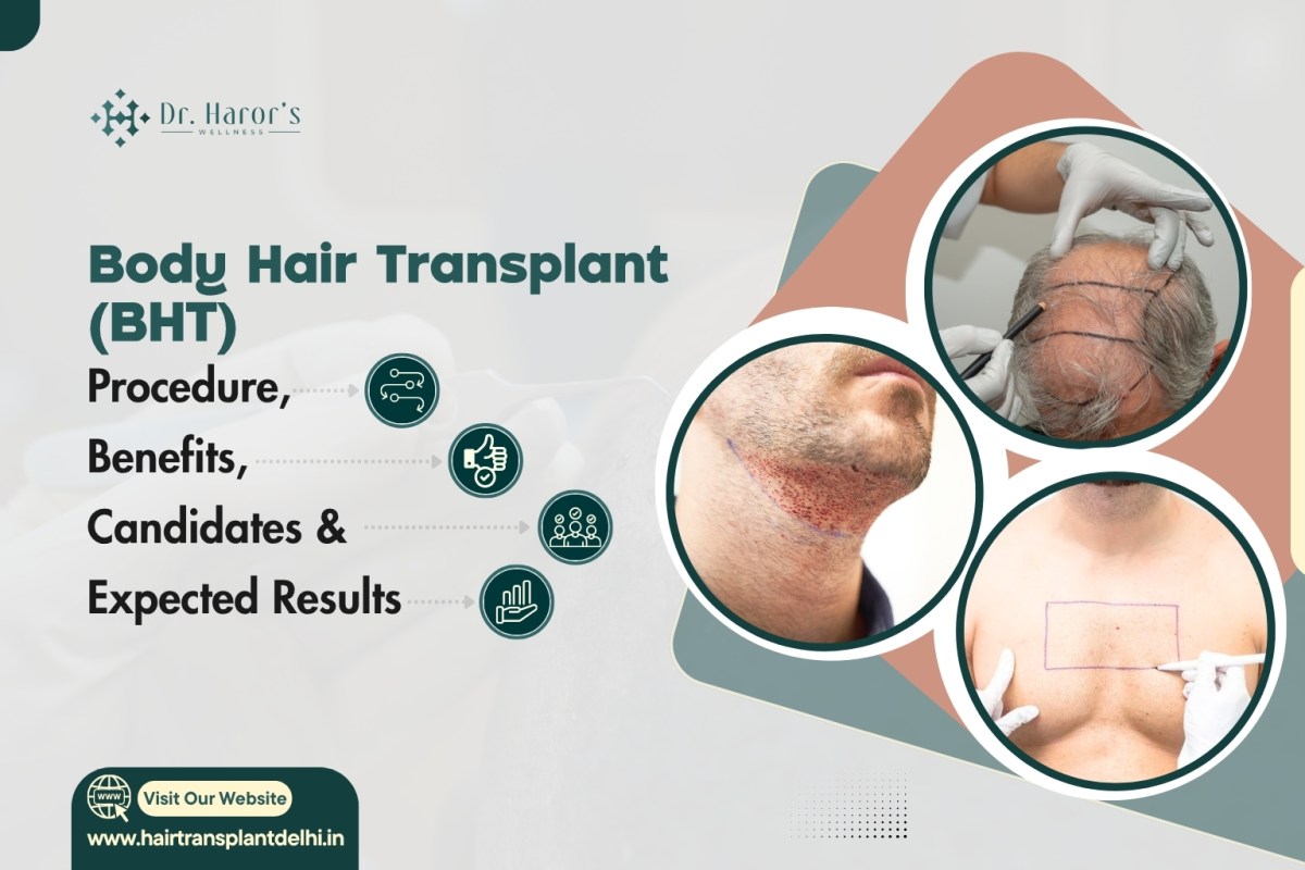 Body Hair Transplant (BHT): Procedure, Benefits, Candidates & Expected Results – hairtransplantclinicinidia
