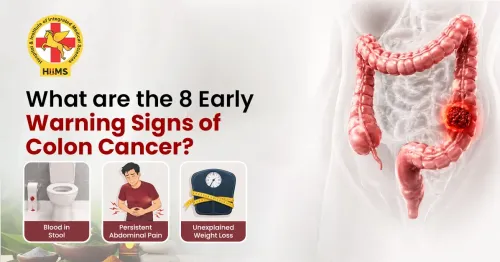 What Are the 8 Early Warning Signs of Colon Cancer? |