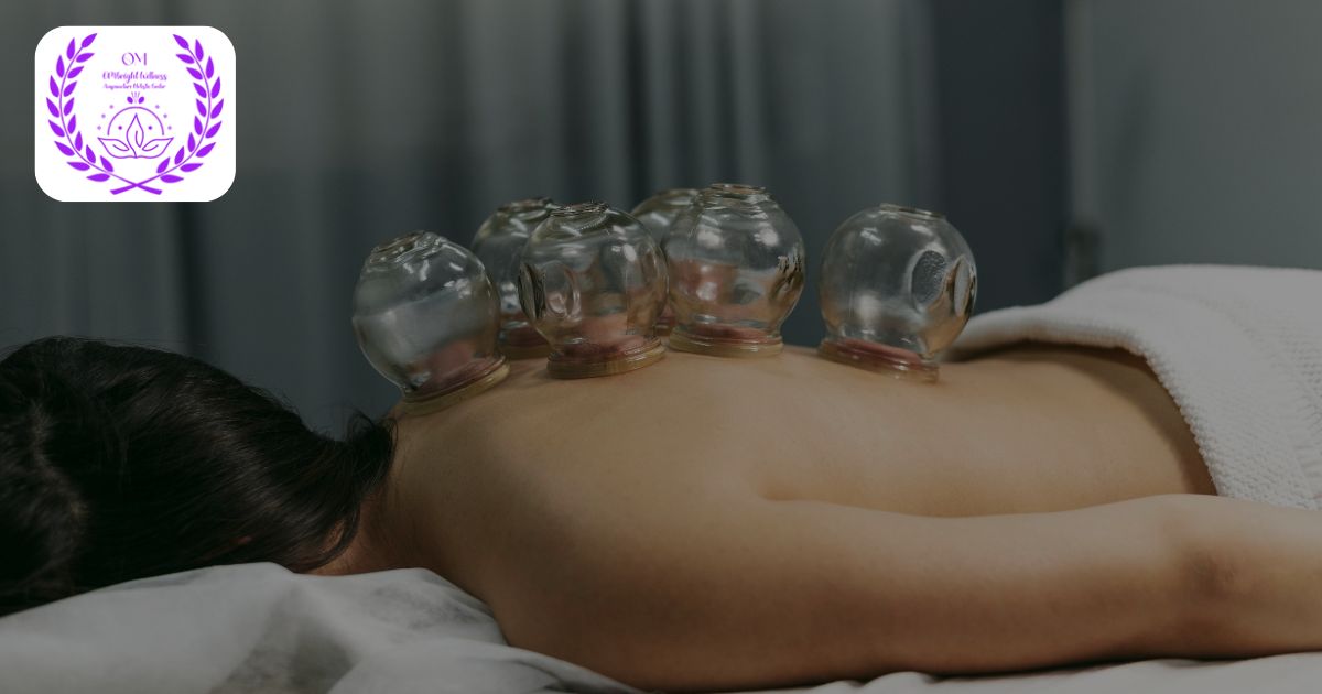 What Happens During Cupping Therapy? | Miami, FL