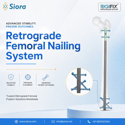 Multilock Retrograde Femoral Nail Short | Siora Surgicals Profile Picture