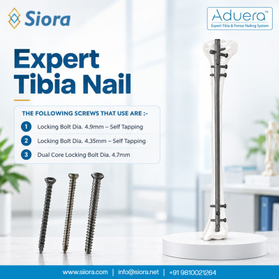 Expert Tibia Nail – Titanium Profile Picture