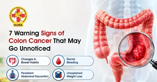 7 Warning Signs of Colon Cancer That May Go Unnoticed