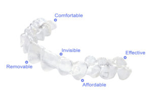 ORTHODONTIC TREATMENT - Dentist Dublin I Dental Clinic Dublin | davincidental.ie