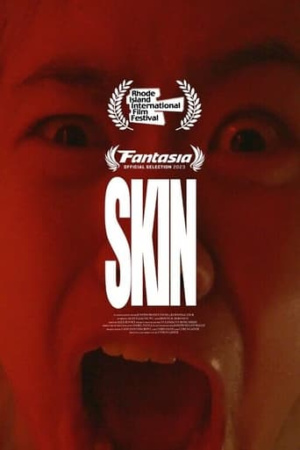 Skin